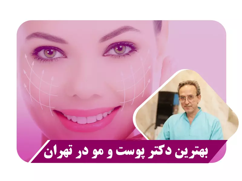 بهترین دکتر پوست و مو در تهران
