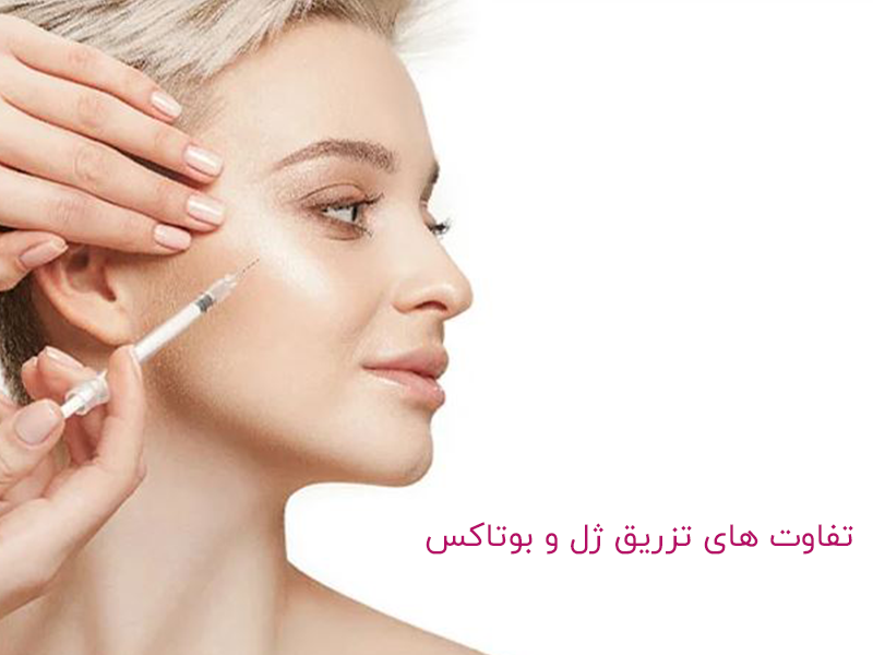 تفاوت های تزریق ژل و بوتاکس