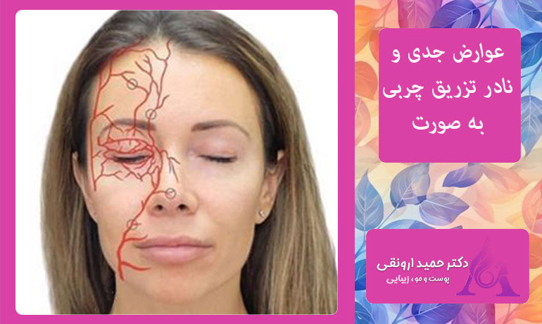 عوارض-جدی-و-نادر-تزریق-چربی-به-صورت