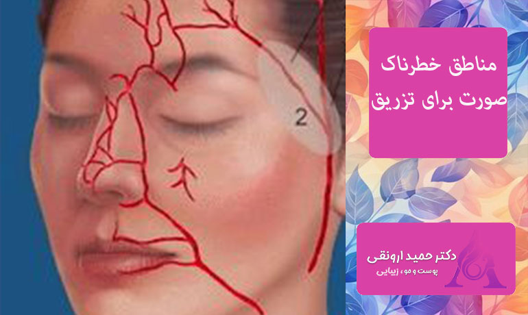 مناطق-خطرناک-صورت-برای-تزریق-چربی