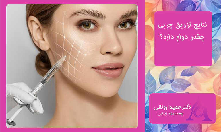 نتایج-تزریق-چربی-چقدر-دوام-دارد؟