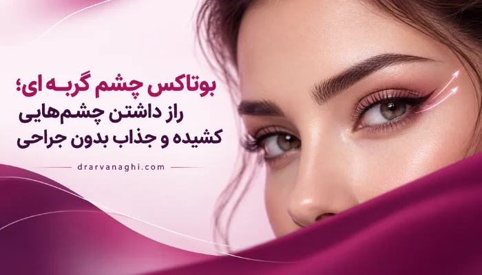 بوتاکس چشم گربه ای برای ایجاد چشمهایی کشیده و جذاب بدون جراحی
