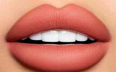 تزریق ژل لب قلوه‌ ای 100% تضمینی + نمونه کار