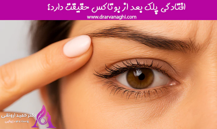 افتادگی پلک بعد از بوتاکس