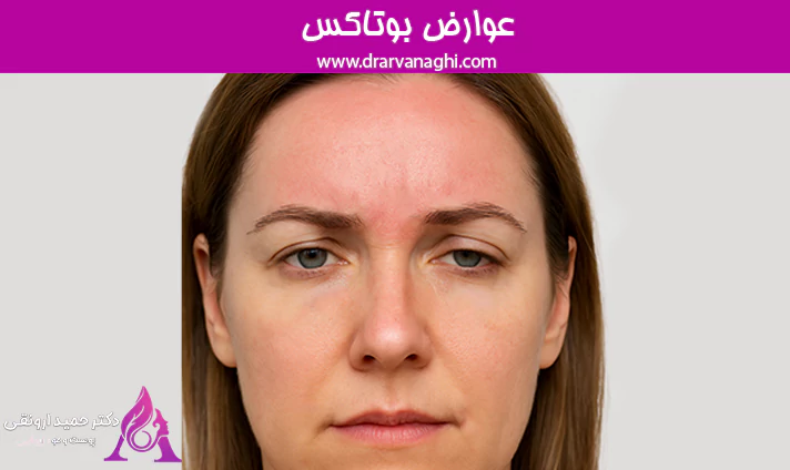 عوارض بوتاکس