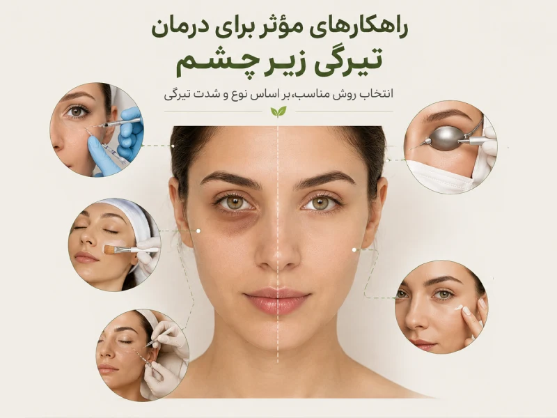 درمان تیرگی زیر چشم