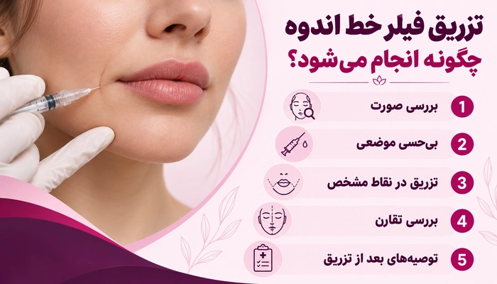 مراحل تزریق فیلر خط اندوه از بررسی صورت و بیحسی موضعی تا تزریق ژل و بررسی تقارن